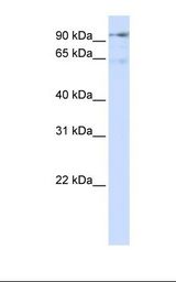 Transfected 293T cell lysate. Antibody concentration: 1.0 ug/ml. Gel concentration: 12%.