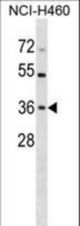 HUS1 Antibody western blot of NCI-H460 cell line lysates (35 ug/lane). The HUS1 antibody detected the HUS1 protein (arrow).