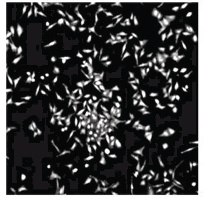 FMAT Analysis: HeLa Cells Stained with a 1/200 dilution of anti-Hecth9 ascites