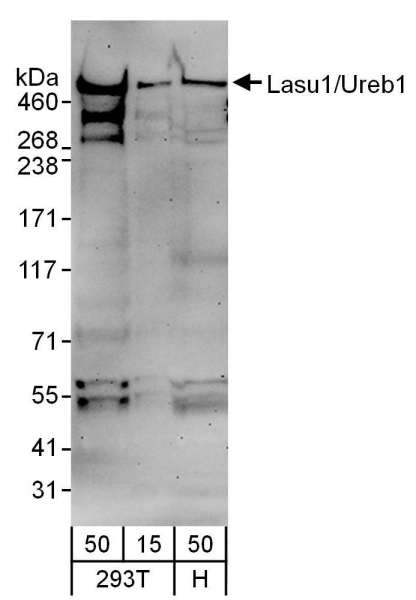 Detection of Human Lasu1/Ureb1 by Western Blot. Samples: Whole cell lysate from 293T (15 and 50 ug) and HeLa (H; 50 ug) cells. Antibodies: Affinity purified goat anti-Lasu1/Ureb1 antibody used for WB at 1 ug/ml. Detection: Chemiluminescence with an exposure time of 3 minutes.