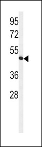 Western blot of HVCN1 Antibody in Jurkat cell line lysates (35 ug/lane). HVCN1 (arrow) was detected using the purified antibody.