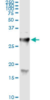 Immunoprecipitation of HYAL1 transfected lysate using anti-HYAL1 monoclonal antibody and Protein A Magnetic Bead, and immunoblotted with HYAL1 rabbit polyclonal antibody.