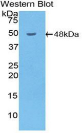 Western blot of recombinant HYAL1.
