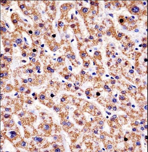 HYAL1 Antibody immunohistochemistry of formalin-fixed and paraffin-embedded human liver tissue followed by peroxidase-conjugated secondary antibody and DAB staining.