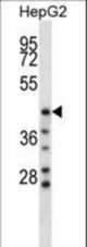 HYAL1 Antibody western blot of HepG2 cell line lysates (35 ug/lane). The HYAL1 antibody detected the HYAL1 protein (arrow).