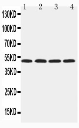 HYAL1 antibody Western blot. Lane 1: NRK Cell Lysate. Lane 2: Mouse Liver Tissue Lysate. Lane 3: Mouse Kidney Tissue Lysate. Lane 4: SP2/0 Cell Lysate.