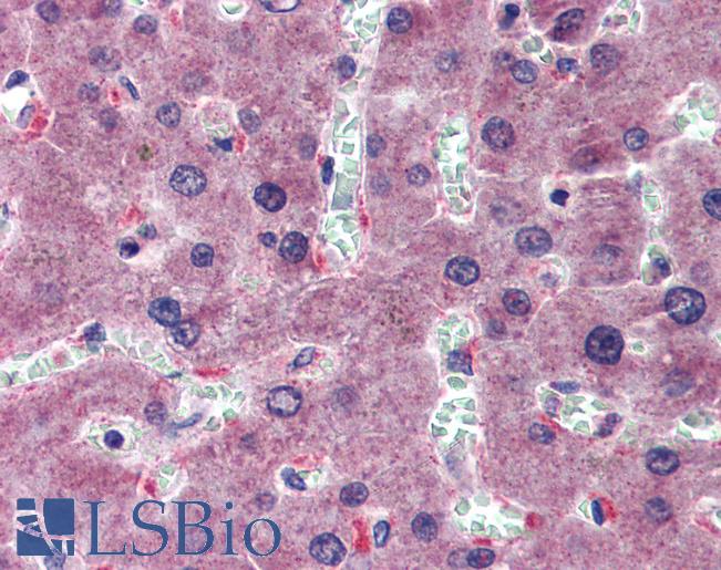 Anti-HYAL1 antibody IHC of human liver. Immunohistochemistry of formalin-fixed, paraffin-embedded tissue after heat-induced antigen retrieval. Antibody LS-B3995 concentration 5 ug/ml.