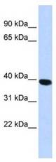 Western analysis of HepG2 cell lysate.