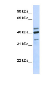 HYAL1 antibody LS-C111296 Western blot of Fetal Brain lysate.