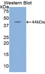 Western blot of recombinant HYAL2.