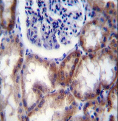 HYAL2 Antibody immunohistochemistry of formalin-fixed and paraffin-embedded human kidney tissue followed by peroxidase-conjugated secondary antibody and DAB staining.