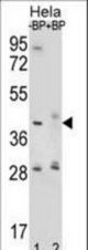Western blot of HYAL2 Antibody antibody pre-incubated without(lane 1) and with(lane 2) blocking peptide in HeLa cell line lysate. HYAL2 Antibody (arrow) was detected using the purified antibody.
