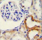 HYAL2 Antibody immunohistochemistry of formalin-fixed and paraffin-embedded human kidney tissue followed by peroxidase-conjugated secondary antibody and DAB staining.
