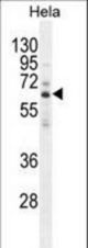 HYAL2 Antibody western blot of HeLa cell line lysates (35 ug/lane). The HYAL2 antibody detected the HYAL2 protein (arrow).
