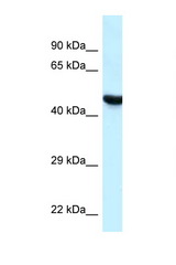 HYAL3 antibody LS-C145572 Western blot of MCF7 Cell lysate. Antibody concentration 1 ug/ml.