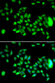 Immunofluorescence blot of U20S cell using HYAL3 antibody. Blue: DAPI for nuclear staining.