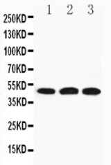 WB of HYAL3 antibody. All lanes: Anti-HYAL3 at 0.5ug/ml. Lane 1: 22RV Whole Cell Lysate at 40ug. Lane 2: HELA Whole Cell Lysate at 40ug. Lane 3: V20S Whole Cell Lysate at 40ug. Predicted bind size: 47KD. Observed bind size: 47KD.