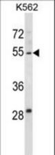 HYAL4 Antibody western blot of K562 cell line lysates (35 ug/lane). The HYAL4 antibody detected the HYAL4 protein (arrow).