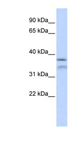 HYLS1 antibody LS-C111653 Western blot of 293T cell lysate.