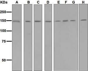 Western blot analysis on (A) fetal liver, (B) rat liver, (C) rat pancreas, (D) 293T, (E) MCF-7, (F) MDA-MB-435S, (G) SH-SY5Y, and (H) HeLa lysates using anti-GRP170 / ORP150 antibody.
