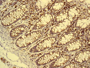 IHC of paraffin-embedded human colon tissue using anti-HYOU1 / ORP150 / ORP150 antibody.