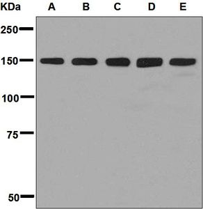 Western blot analysis on (A) HeLa, (B) SH-SY5Y, (C) MCF-7, (D) HepG2, and (E) 293T cell lysates using anti-HYOU1 / ORP150 / ORP150 antibody.