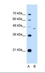 Lane A: Marker. Lane B: HepG2 cell lysate. Antibody concentration: 2.5 ug/ml. Gel concentration: 12%.