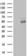 HEK293T cells were transfected with the pCMV6-ENTRY control (Left lane) or pCMV6-ENTRY FICD (Right lane) cDNA for 48 hrs and lysed. Equivalent amounts of cell lysates (5 ug per lane) were separated by SDS-PAGE and immunoblotted with anti-FICD.