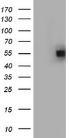 HEK293T cells were transfected with the pCMV6-ENTRY control (Left lane) or pCMV6-ENTRY FICD (Right lane) cDNA for 48 hrs and lysed. Equivalent amounts of cell lysates (5 ug per lane) were separated by SDS-PAGE and immunoblotted with anti-FICD.