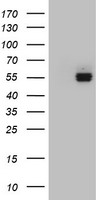 HEK293T cells were transfected with the pCMV6-ENTRY control (Left lane) or pCMV6-ENTRY FICD (Right lane) cDNA for 48 hrs and lysed. Equivalent amounts of cell lysates (5 ug per lane) were separated by SDS-PAGE and immunoblotted with anti-FICD.