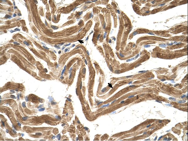 FICD / HYPE antibody LS-C80941 was used in IHC to stain formalin-fixed, paraffin-embedded human muscle.