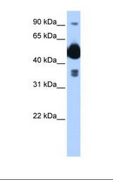 Transfected 293T cell lysate. Antibody concentration: 0.25 ug/ml. Gel concentration: 12%.
