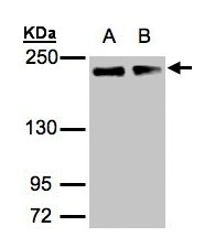 Sample (30 ug of whole cell lysate). A: A431, B: H1299. 5% SDS PAGE. GOLGA3 antibody diluted at 1:1000