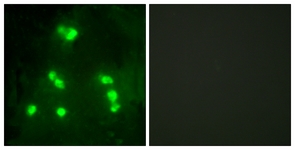 Immunofluorescence of A549 cells, using HAIR Antibody. The picture on the right is treated with the synthesized peptide.