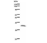 Western blot analysis of immunized recombinant protein, using anti-HR monoclonal antibody.