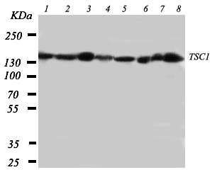 WB of Hamartin / TSC1 antibody. Lane 1: Rat Skeletal Muscle Tissue Lysate. Lane 2: Rat Heart Tissue Lysate. Lane 3: Rat Brain Tissue Lysate. Lane 4: Rat Lung Tissue Lysate. Lane 5: 293t Cell Lysate. Lane 6: HELA Cell Lysate. Lane 7: HT1080 Cell Lysate. Lane 8: SMMC Cell Lysate. Lane 9: PANV Cell Lysate..