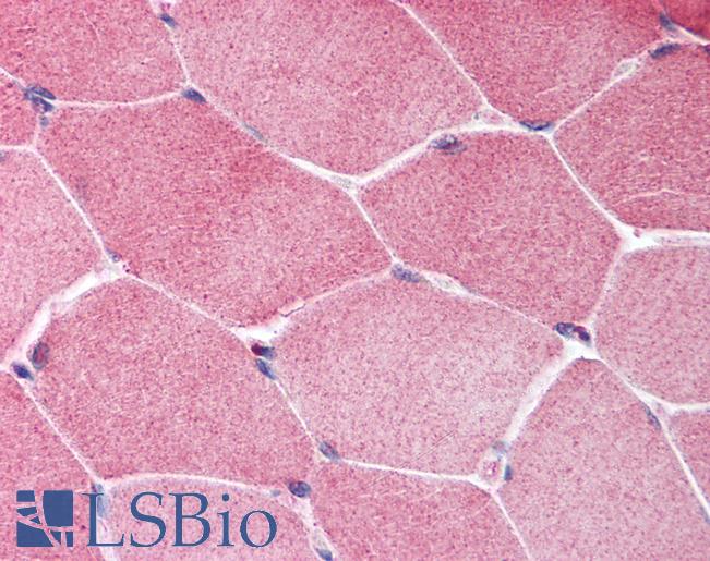 Anti-TSC1 antibody IHC of human skeletal muscle. Immunohistochemistry of formalin-fixed, paraffin-embedded tissue after heat-induced antigen retrieval. Antibody LS-B1431 concentration 5 ug/ml.