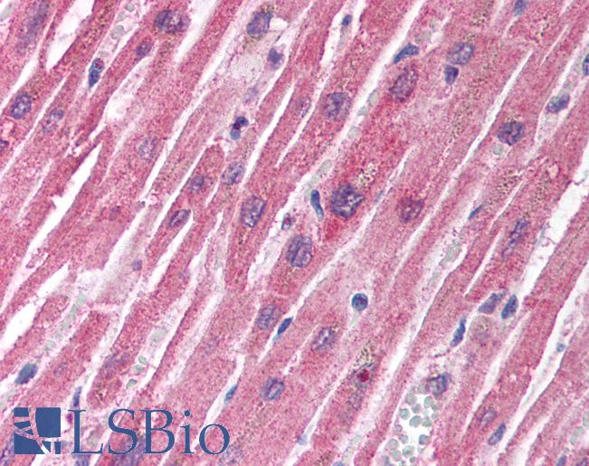 Anti-TSC1 antibody IHC of human heart. Immunohistochemistry of formalin-fixed, paraffin-embedded tissue after heat-induced antigen retrieval. Antibody LS-B1431 concentration 5 ug/ml.