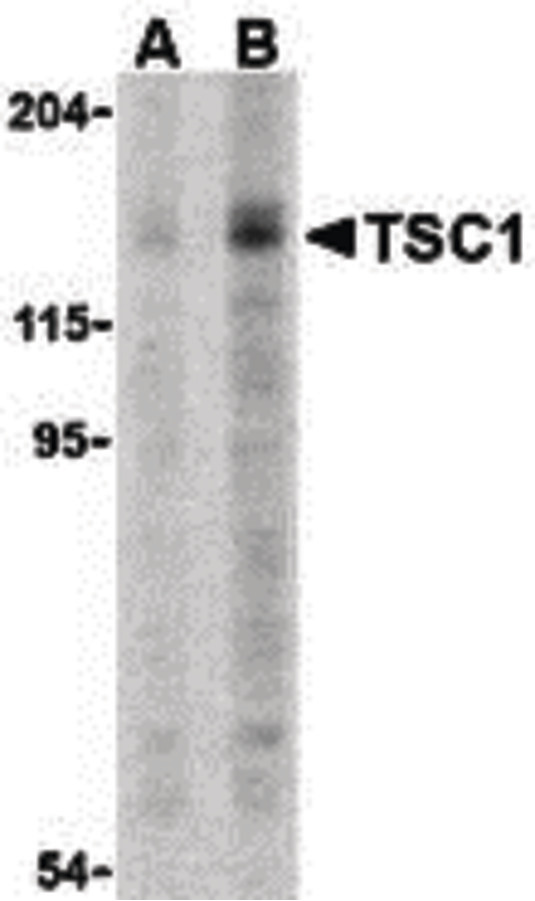 Western blot of TSC1 in C2C12 cell lysate with TSC1 antibody at (A) 2 and (B) 4 ug.