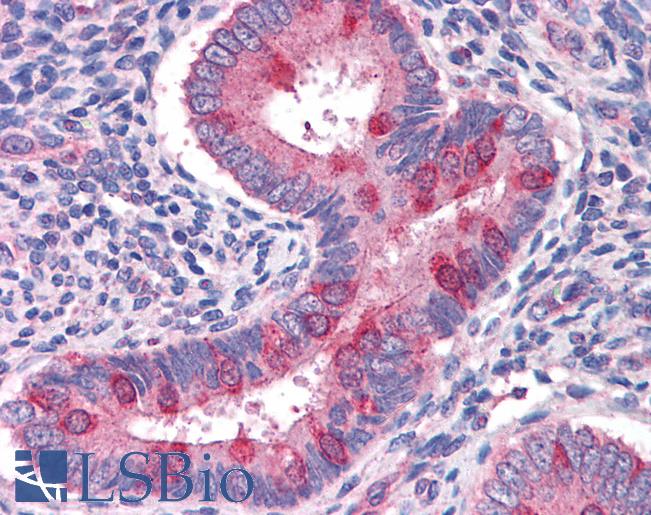 Anti-TSC1 antibody IHC of human uterus. Immunohistochemistry of formalin-fixed, paraffin-embedded tissue after heat-induced antigen retrieval. Antibody LS-B4456 concentration 3.75 ug/ml.