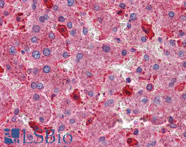 Anti-TSC1 antibody IHC of human liver. Immunohistochemistry of formalin-fixed, paraffin-embedded tissue after heat-induced antigen retrieval. Antibody LS-B4456 concentration 3.75 ug/ml.