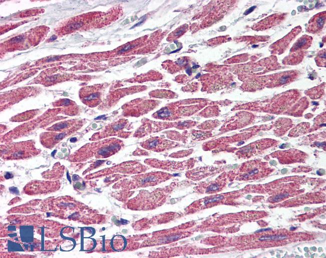 Anti-TSC1 antibody IHC of human heart. Immunohistochemistry of formalin-fixed, paraffin-embedded tissue after heat-induced antigen retrieval. Antibody LS-B612 concentration 5 ug/ml.