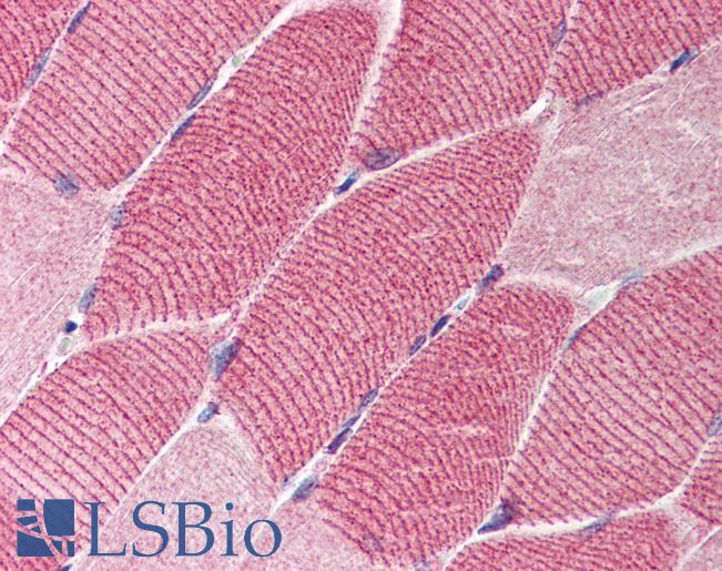 Anti-TSC1 antibody IHC of human skeletal muscle. Immunohistochemistry of formalin-fixed, paraffin-embedded tissue after heat-induced antigen retrieval. Antibody LS-B612 concentration 5 ug/ml.