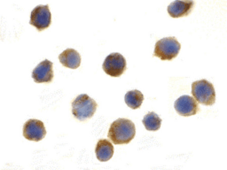 Immunocytochemistry of TSC1 in EL4 cells with TSC1 antibody at 2 ug/ml