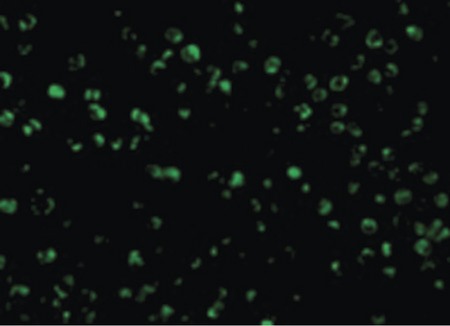 Immunofluorescence of TSC1 in L1210 cells with TSC1 antibody at 10 ug/ml.