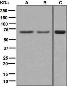 Western blot analysis on (A) fetal kidney, (B) human colon, and (C) Caco-2 lysates using anti-USH1C antibody.