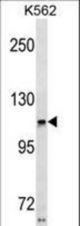 USH1C Antibody western blot of K562 cell line lysates (35 ug/lane). The USH1C antibody detected the USH1C protein (arrow).