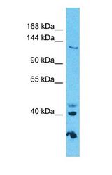 Western blot of GOLGA3 Antibody with human HepG2 Whole Cell lysate.