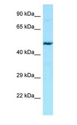 Heparanase 2 / HPSE2 antibody Western Blot of Jurkat.