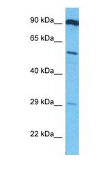Western blot of HPSE2 Antibody with human MCF7 Whole Cell lysate.